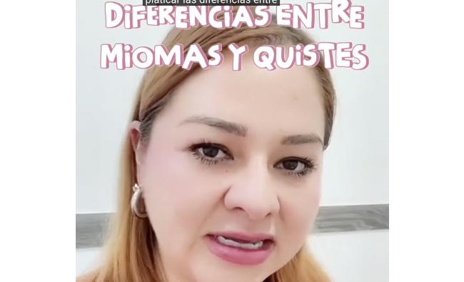 Diferencia entre miomas y quistes